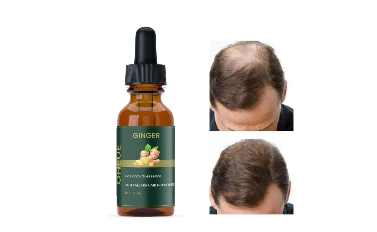 Ginger Hair Growth Essence 60ml Pack Of 2